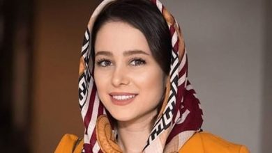 چهره باورنکردنی الناز حبیبی قبل و بعد از جراحی های زیبایی – ایران فور فان
