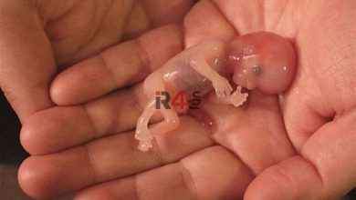 ساخت جنین مصنوعی انسان غوغا به پا کرد! + عکس عجیب –   ایران فورفان