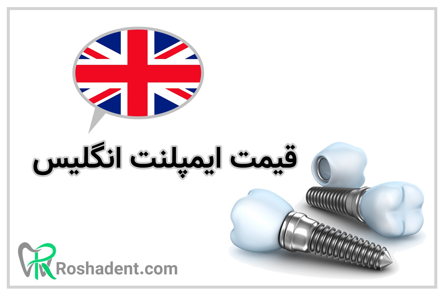 قیمت ایمپلنت دندان در انگلیس