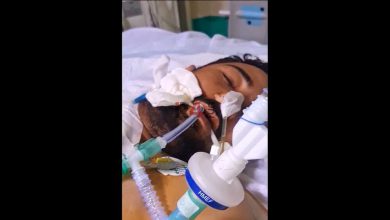شاهکار جدید جراحان ایرانی / جراحی موفقیت‌آمیز پیوند سر قطع شده به بدن در ایران + فیلم –   ایران فورفان