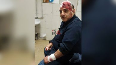 حمله به یک مسئول ایرانی با چاقو و قمه + عکس –   ایران فورفان