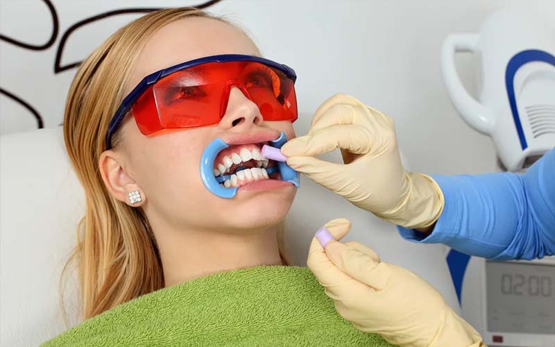 بهترین مرکز بلچینگ دندان در کرج