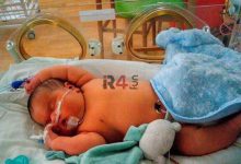 تولد یک نوزاد سنگین وزن در میاندوآب + عکس –   ایران فورفان
